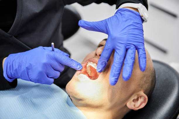 Best Knocked-Out Tooth (Avulsed Tooth) Treatment in South Barre, VT