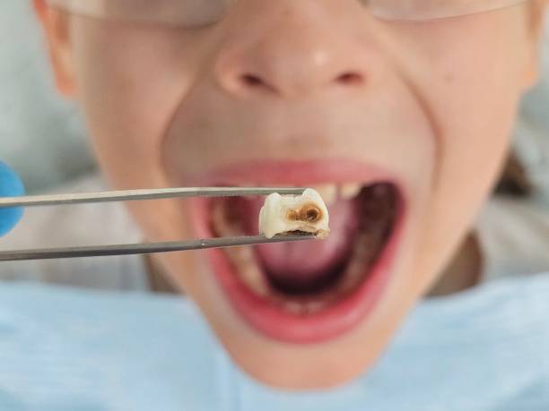 Best Emergency Orthodontic Repairs in South Barre, VT