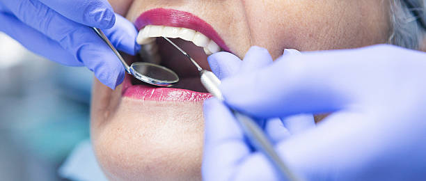 Best Emergency Wisdom Tooth Extraction in South Barre, VT